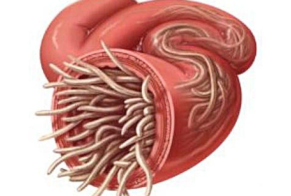 Ionic Foot Detox, Parasites, and You