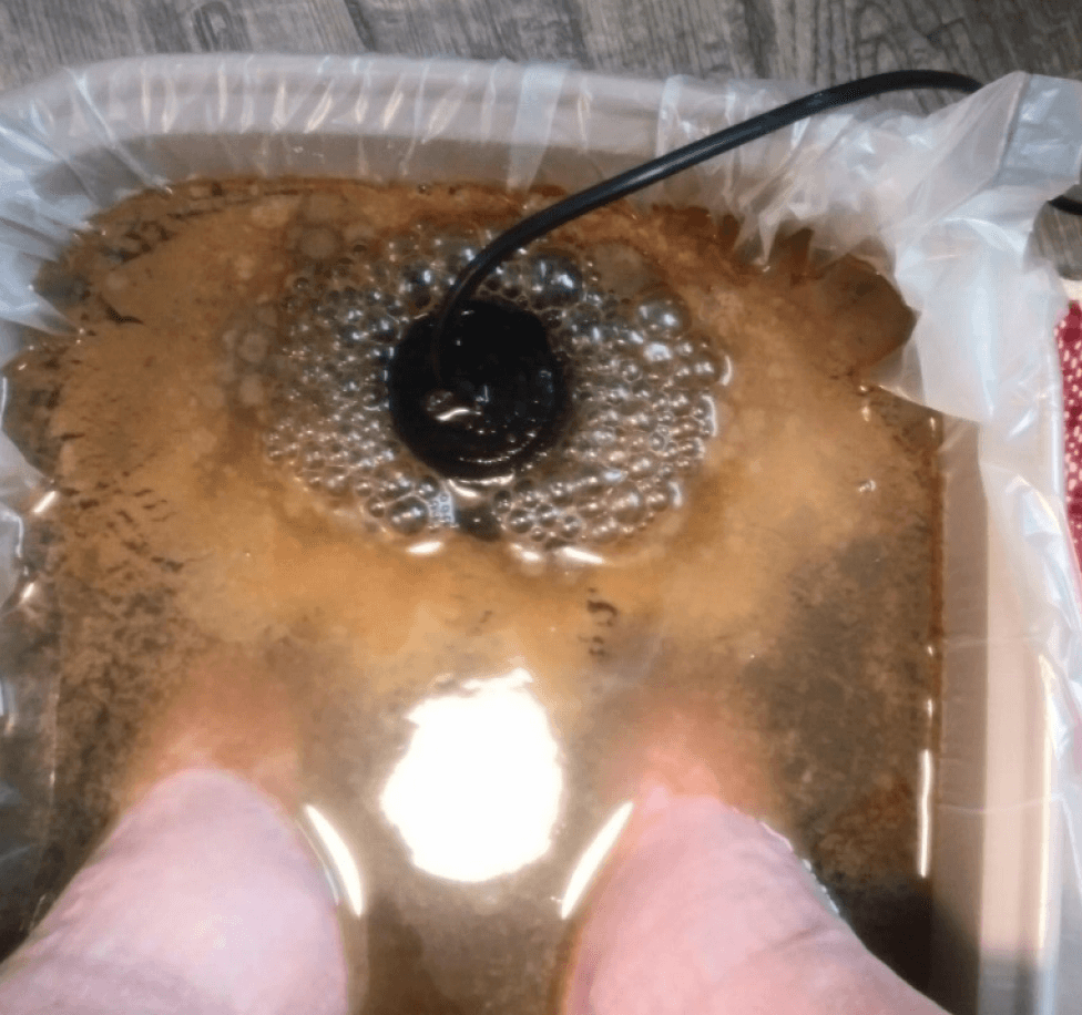 Yeast in the Ionic Foot Bath Water